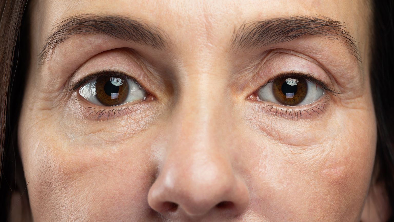 Cómo combatir las ojeras de los ojos en un centro de estética