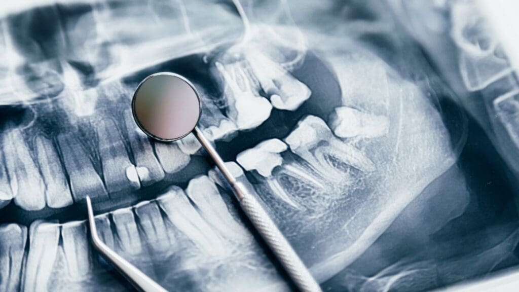 Imagen de una clínica dental moderna con equipo profesional y tecnología avanzada para cuidar tu salud bucodental.