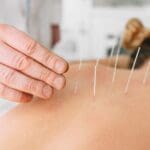 ACUPUNTURA Y MASAJES