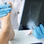 Traumatólogo en consulta médica evaluando el pie de un paciente con dolor o lesión en clínica especializada
