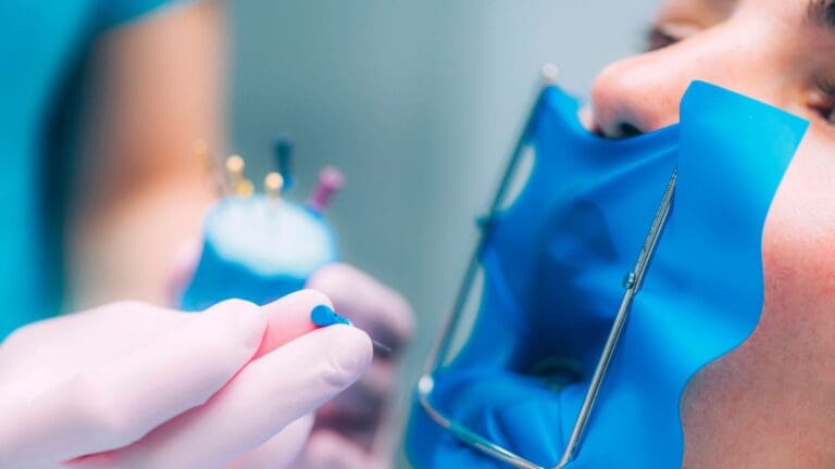 ¿Por qué la endodoncia es clave para salvar tus dientes?