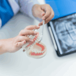 implantes dentales