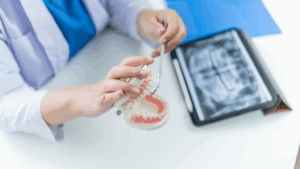implantes dentales