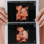 Fotos de ecografía 4D que capturan momentos irrepetibles del embarazo