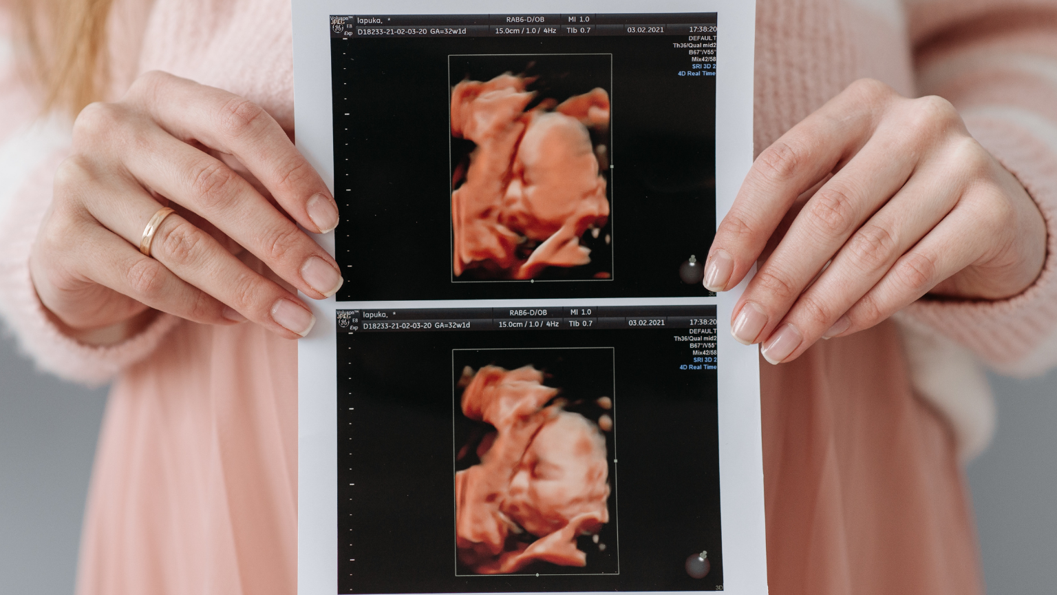 Fotos de ecografía 4D que capturan momentos irrepetibles del embarazo