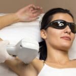 Tratamiento de depilación láser diodo en centro de estética profesional