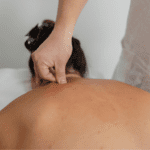 Sesión de acupuntura realizada por profesional en centro de bienestar.