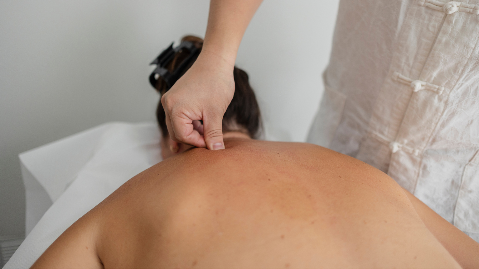 Sesión de acupuntura realizada por profesional en centro de bienestar.