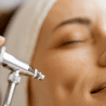 oxigenoterapia facial