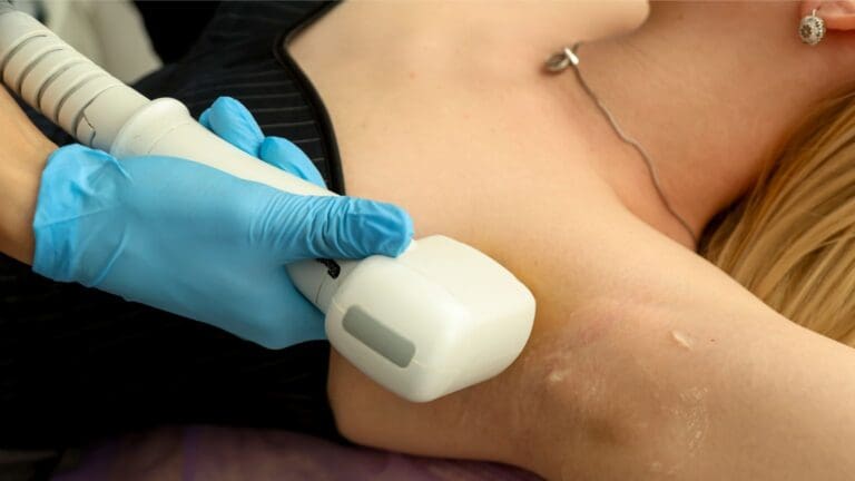 Tratamiento de depilación láser definitiva realizado por profesional en centro de estética en Barcelona