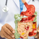 Descubre tratamientos médicos para enfermedades digestivas