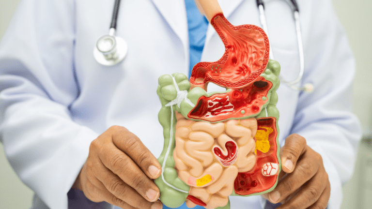 Descubre tratamientos médicos para enfermedades digestivas