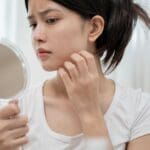 ¿Cuándo acudir a un dermatólogo para cuidar tu piel y cabello?