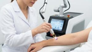 ¿Qué es el laser q Switch y cómo funciona para la piel?