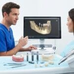 ¿Qué son los sistemas de implantes dentales y cómo se eligen?
